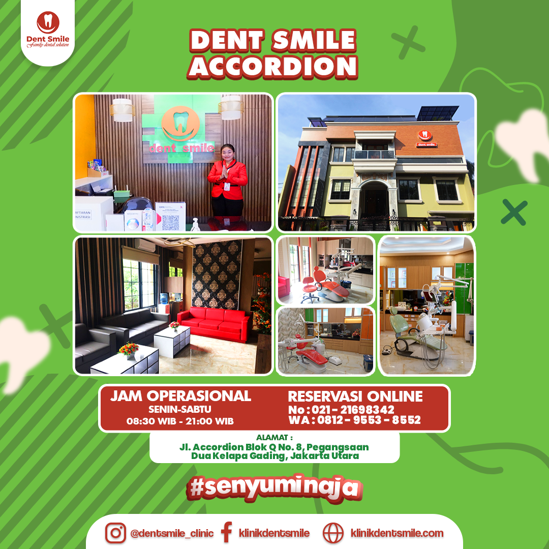 dent-smile-accordion