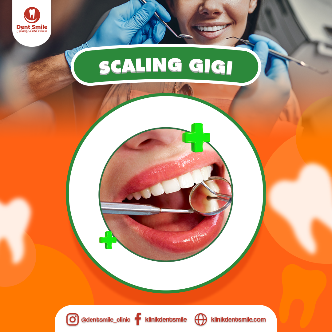 scaling-gigi